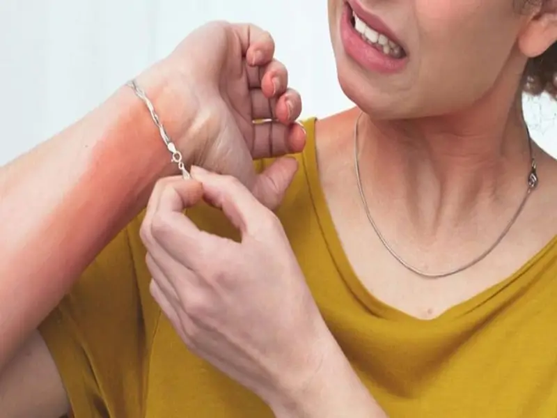 علائم حساسیت به طلا روی پوست و بدن 